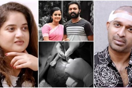 ഇതെന്തുപറ്റി.!! 6 മണിക്കൂർ നീണ്ടു നിന്ന പ്രക്രിയ; ഒരു കൊച്ചുകുഞ്ഞിനെ പോലെയാണ് ഇവർ എന്നെ നോക്കിയത്.. തുറന്ന് പറഞ്ഞ് ശിവേട്ടൻ | Santhwanam Sajin Hair Transplantation video