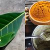 home remedy for migraine headache
